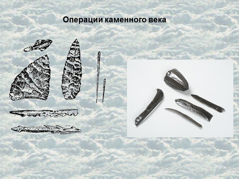 Операции каменного века